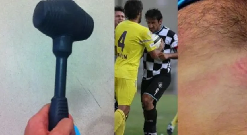 DAYAK YEDİ ÇEKİÇLE SALDIRDI