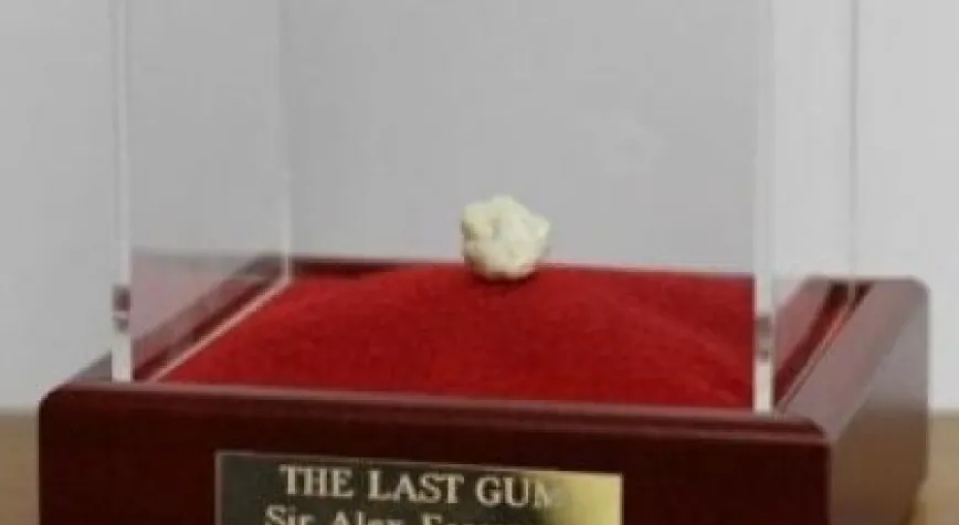 FERGUSON'UN SAKIZI SATIŞTA!